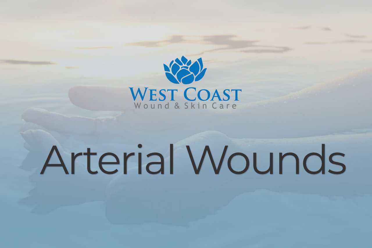 Arterial Wounds Video Thumbnail