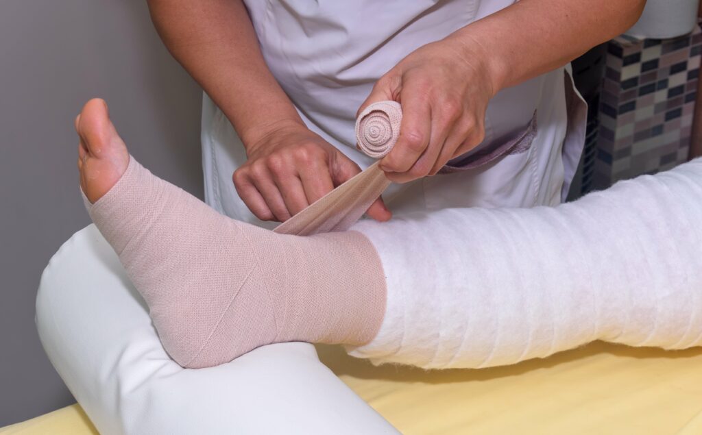 wound care specialist bandaging a leg with lymphedema