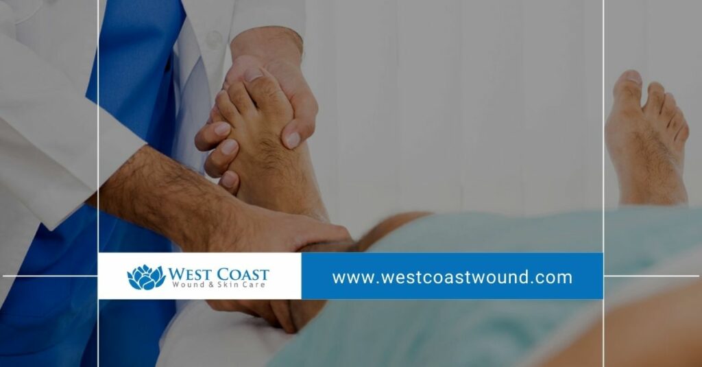 Wound Healing Wound Healing