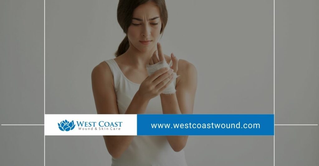 wound treatment wound treatment