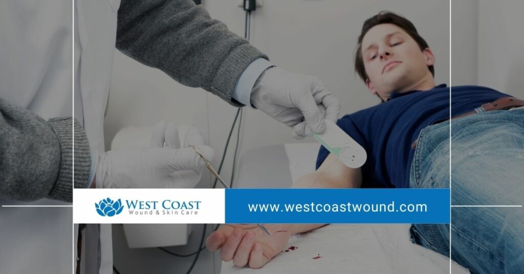 wound care wound care
