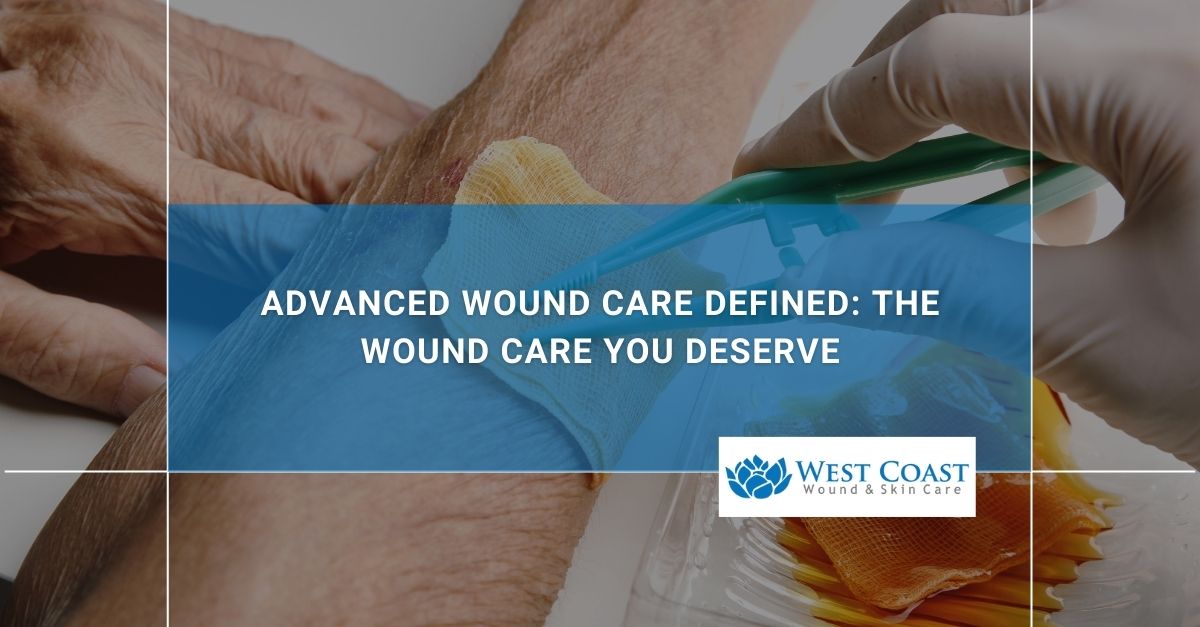 advanced wound care