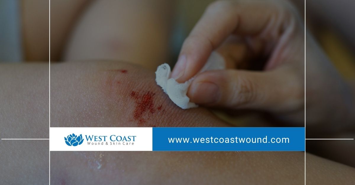 advanced wound care advanced wound care