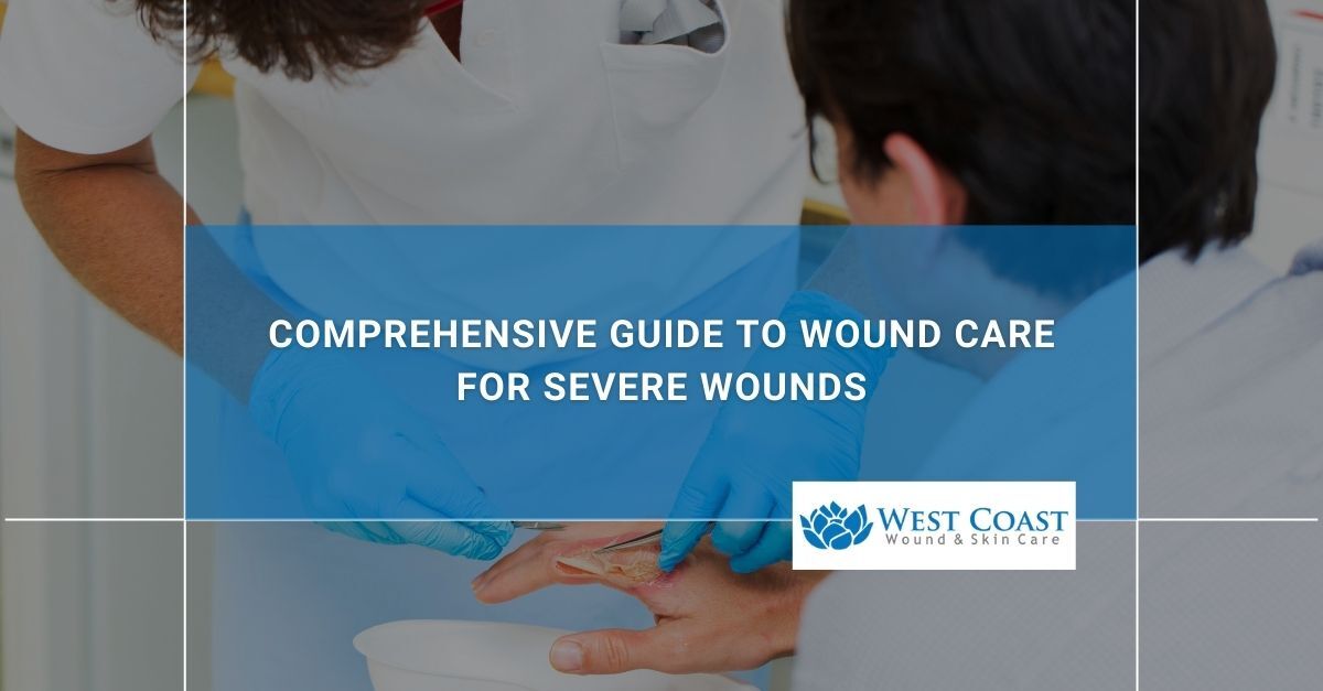 wound care for severe wounds