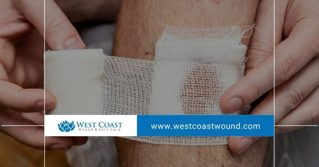 wound care for severe wounds