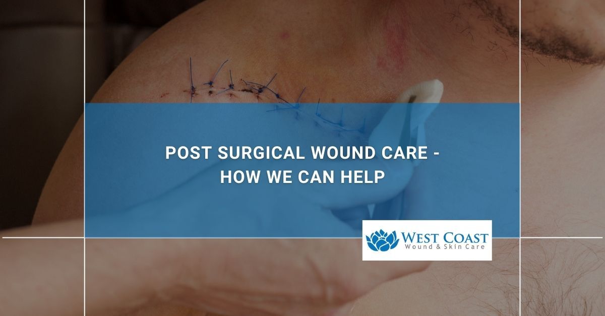 Post Surgical Wound Care
