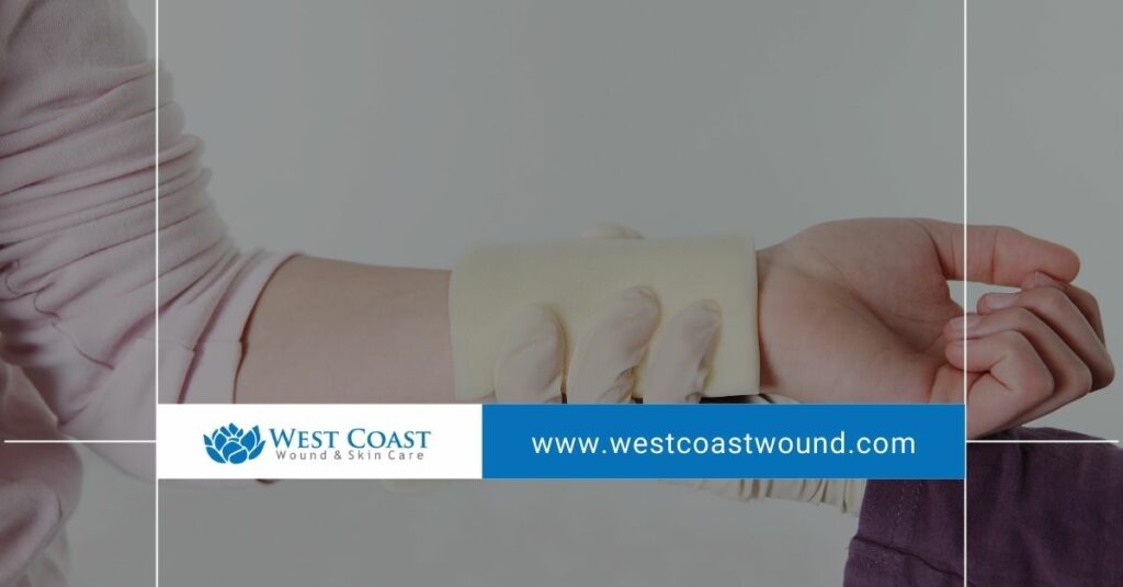 Chronic Wound Care