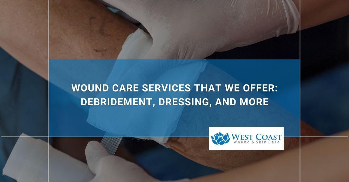 Wound Care Services