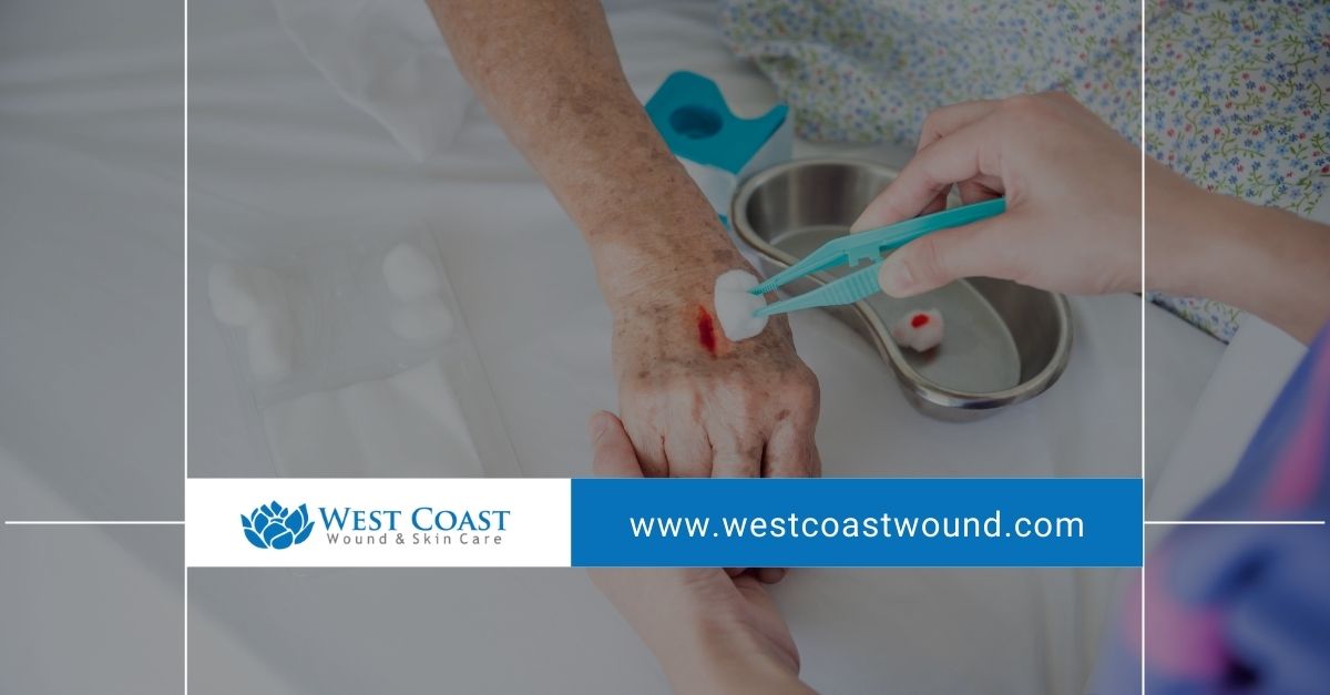 Wound Care Services Wound Care Services