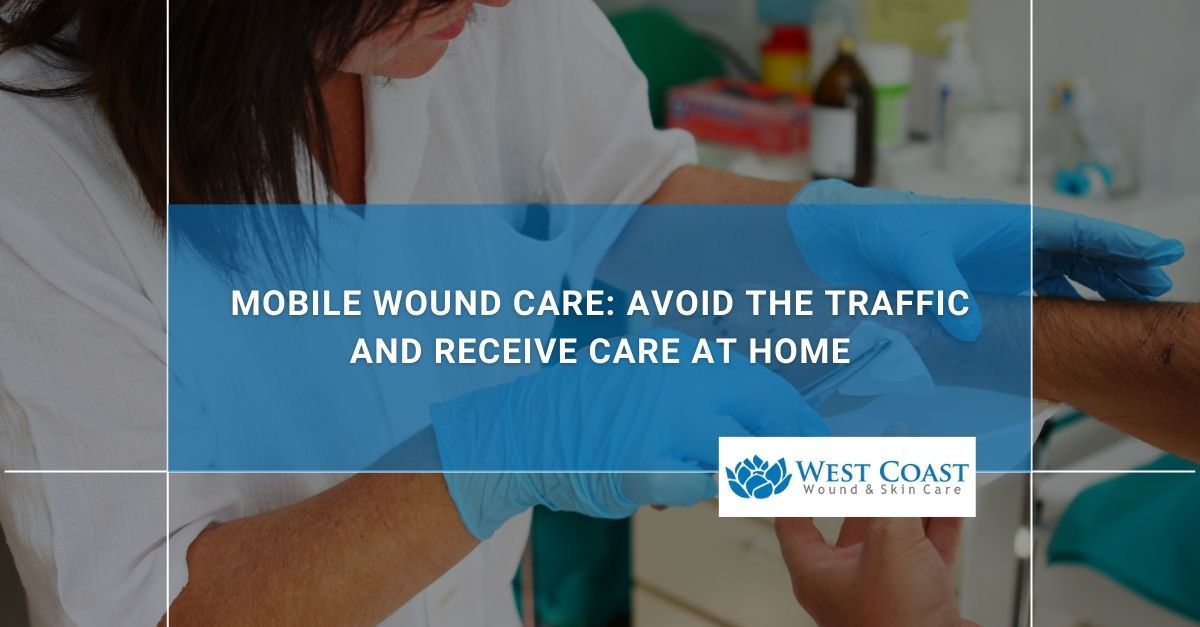 mobile wound care services