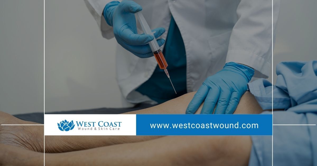 Platelet-Rich Plasma 