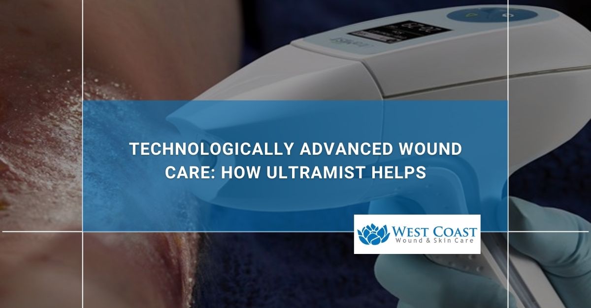 ultramist wound care