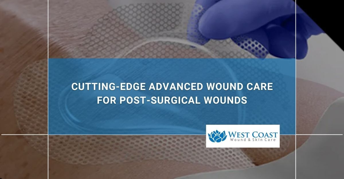 Post-Surgical Wound Care