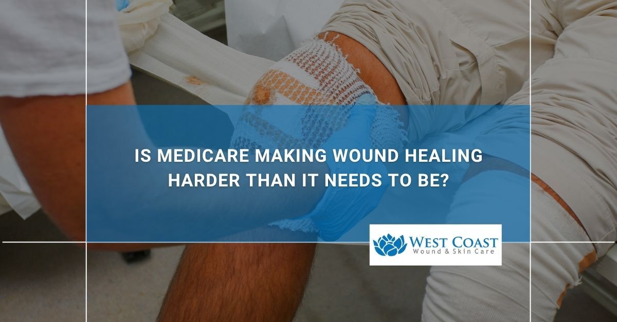 Medicare in Wound Healing
