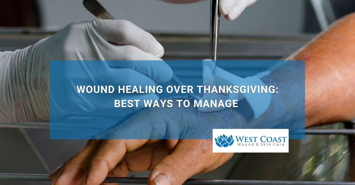 Wound Healing Over Thanksgiving Best Ways to Manage