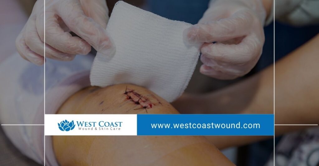 Mobile Wound Care Avoid the Traffic and Receive Care at Home