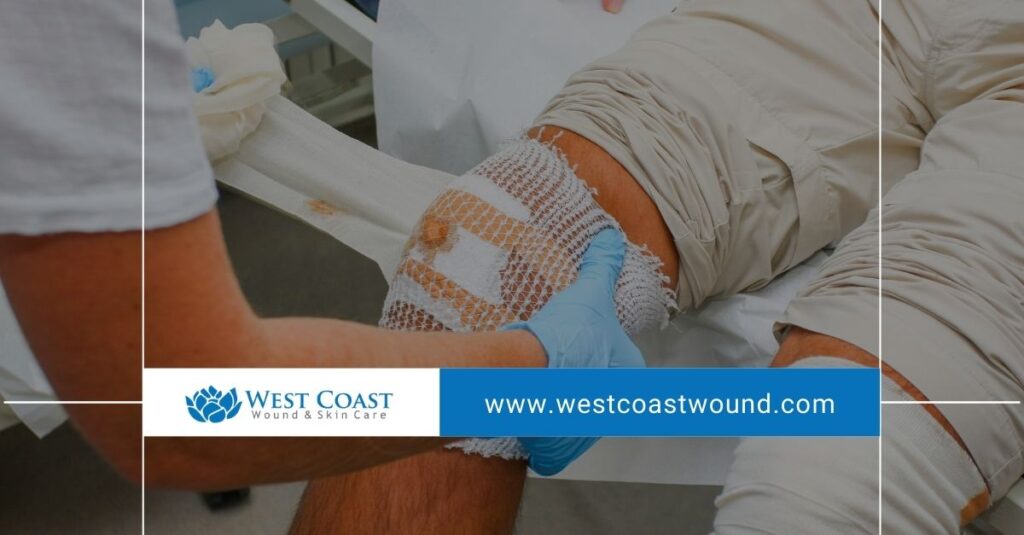 wound care